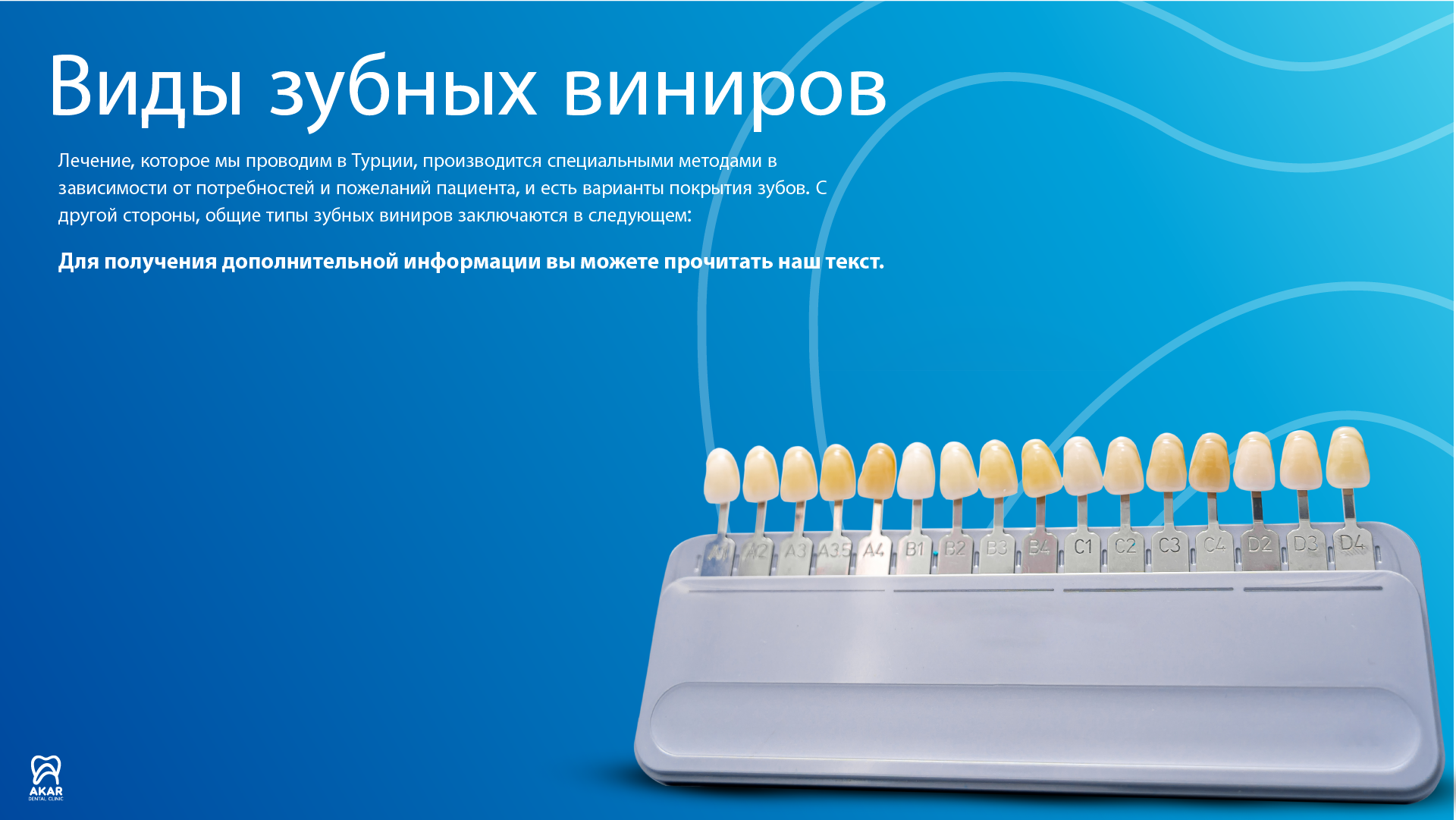 Керамические виниры в Анталии - Akar Dental