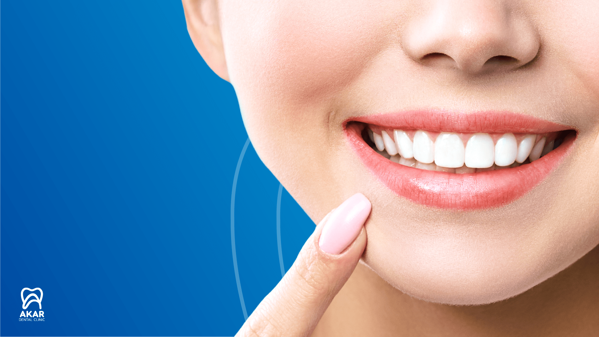 Дизайн улыбки в Анталии - Akar Dental