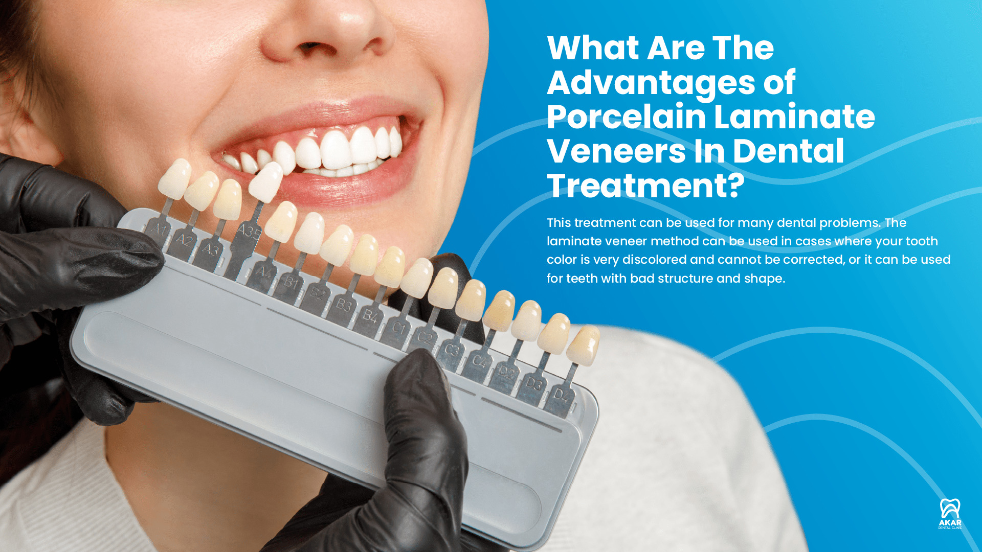 What Are The Disadvantages of Porcelain Laminate Veneers In Dental Treatment? - Turkey - Antalya